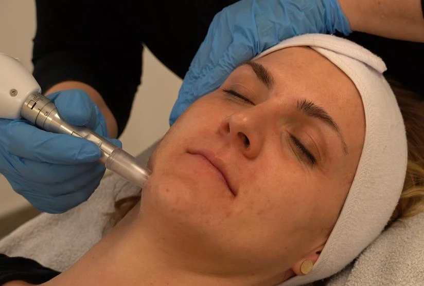 In-treatment precision